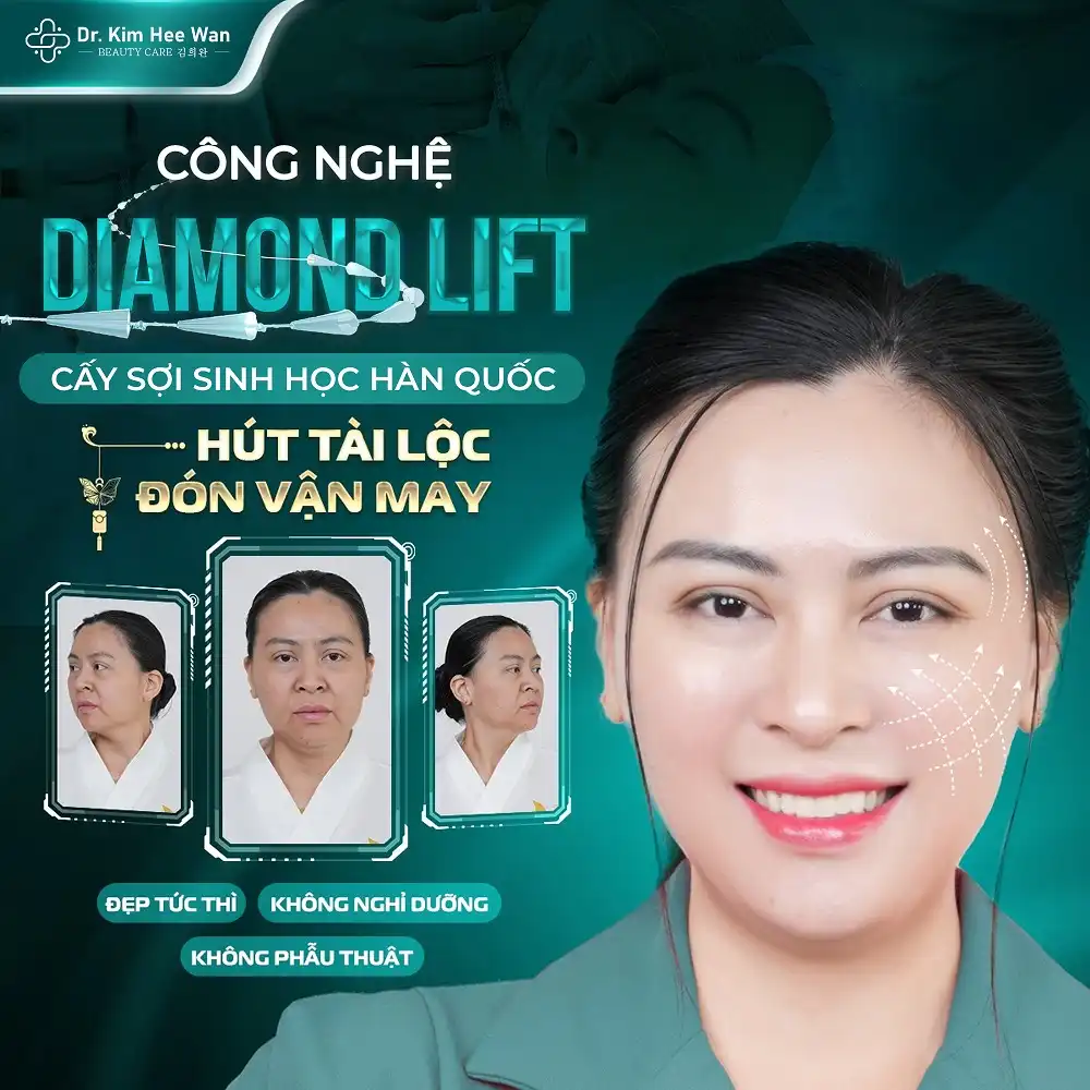 Trẻ hoá làn da bằng Cấy sợi sinh học Diamond Lift