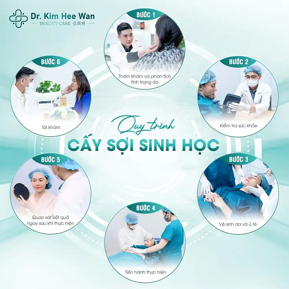 Trẻ hoá làn da bằng Cấy sợi sinh học Diamond Lift