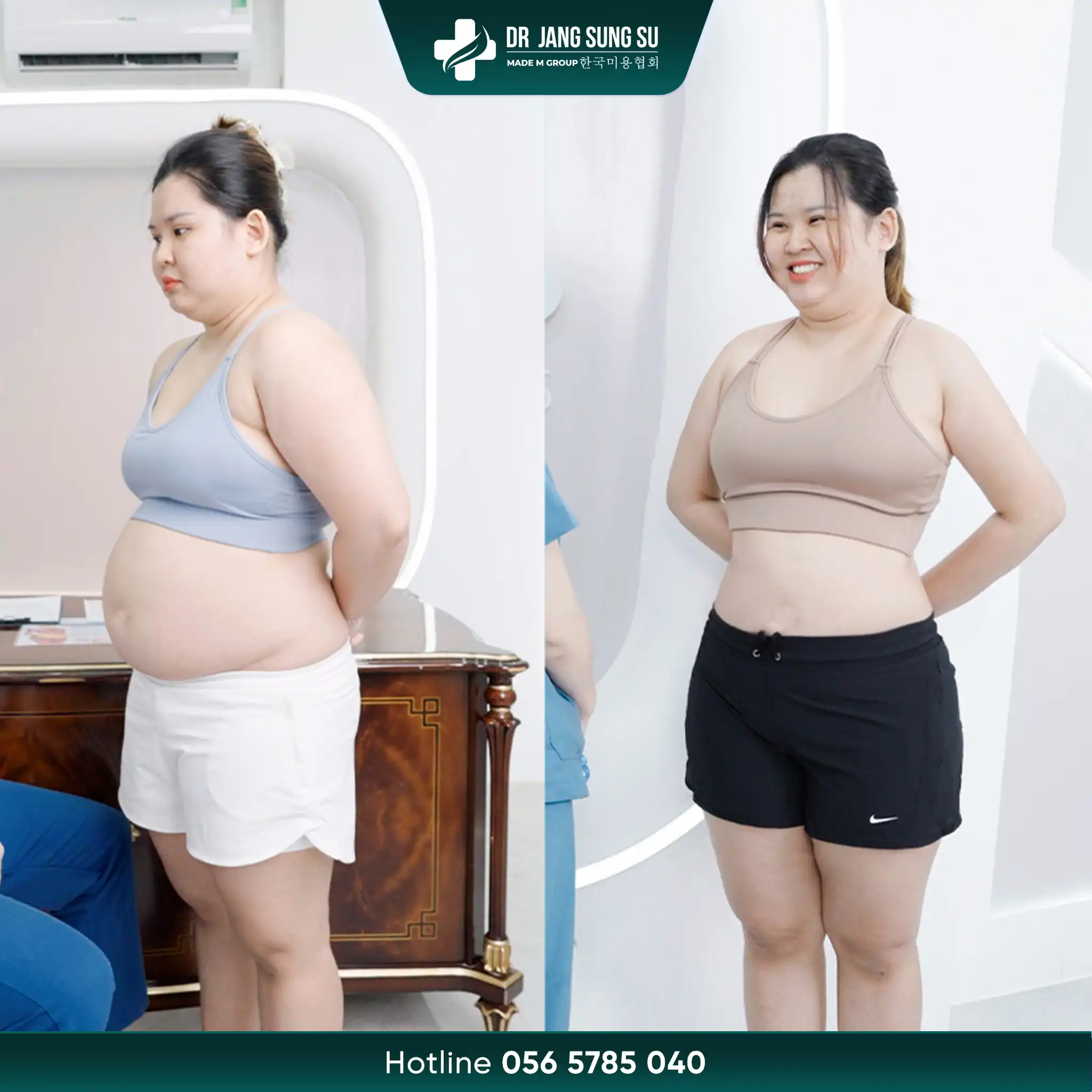 Việt kiều “đổ xô” về Việt Nam làm đẹp với liệu trình Slimtech Lite-X tại Dr. Jang Sung Su